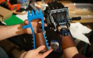 talon hand 20 prosthetiko xeri