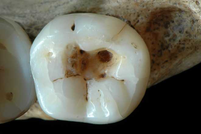 oldest dentistry οδοντίατρο