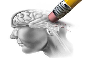 alzheimer
